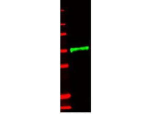 IL-1 Receptor Type IL Polyclonal Antibody 100UL