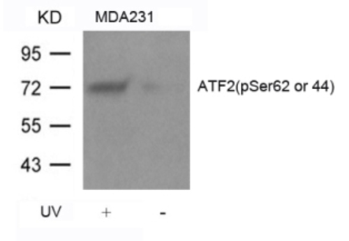 ATF2 (phospho Ser62 / 44) Antibody