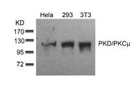 Anti-PRKD1 Rabbit Polyclonal Antibody