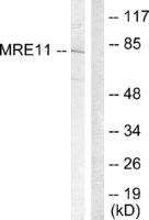 Anti-Mre11 Rabbit Polyclonal Antibody