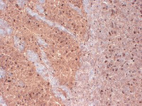 Anti-KCNAB1 Mouse Monoclonal Antibody [clone: S47-42]