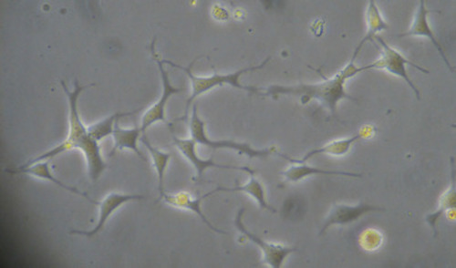 IASTROHUMAN IPSC-DER ASTROC (TYPE 1 II)