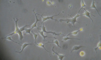 Tempo-iAstro™: Human iPSC-derived Astrocytes (type 1 or II)