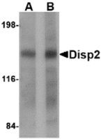 Anti-DISP2 Rabbit Polyclonal Antibody