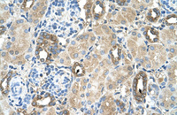 Anti-MGAT2 Rabbit Polyclonal Antibody