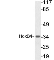 Anti-HOXB4 Rabbit Polyclonal Antibody