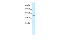 Anti-CMKLR1 Rabbit Polyclonal Antibody