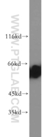 Anti-CBX2 Rabbit Polyclonal Antibody