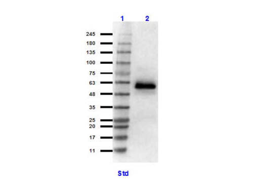 HSF1 Polyclonal Antibody 25UG