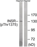 Anti-INSR Rabbit Polyclonal Antibody