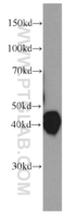 Anti-ORM1 Mouse Monoclonal Antibody [clone: 5F2H7]