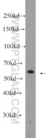 Anti-C6orf204 Rabbit Polyclonal Antibody