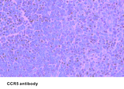 Goat Polyclonal antibody to CCR5 (chemokine (C-C motif) receptor 5)