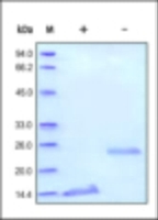 Human Recombinant TGF beta 1 (from HEK293 Cells)