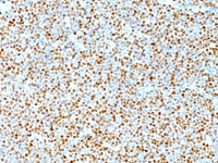 Anti-Cyclin D1 Mouse Monoclonal Antibody [clone: DCS-6]
