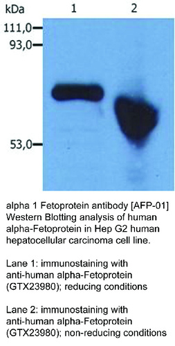 Mouse Monoclonal antibody to alpha 1 Fetoprotein (alpha-fetoprotein)