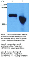 Anti-AFP Mouse Monoclonal Antibody [clone: AFP-1]