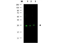 Anti-CDKN1B Rabbit Monoclonal Antibody [clone: 5.C3.1]