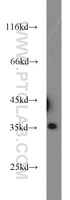 Anti-PPP4C Rabbit Polyclonal Antibody