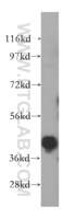 Anti-hnRNP-E1 Rabbit Polyclonal Antibody