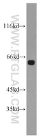 Anti-HBP1 Rabbit Polyclonal Antibody