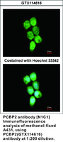 Anti-PCBP2 Rabbit Polyclonal Antibody