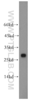 Anti-CMBL Rabbit Polyclonal Antibody