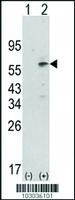 Anti-PDPK1 Rabbit Polyclonal Antibody
