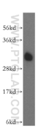 Anti-ATP6V1E1 Rabbit Polyclonal Antibody