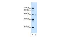 Anti-SLC16A12 Rabbit Polyclonal Antibody