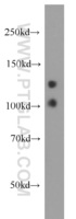Anti-MYO16 Rabbit Polyclonal Antibody