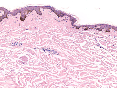 HUMAN SKIN COMPOSITE (SECT) H/E