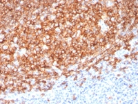 Anti-CD20 Mouse Monoclonal Antibody [Clone: MS4A1/3410]