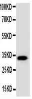 Anti-AQP10 Rabbit Polyclonal Antibody