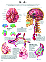 3B Scientific® Stroke Chart