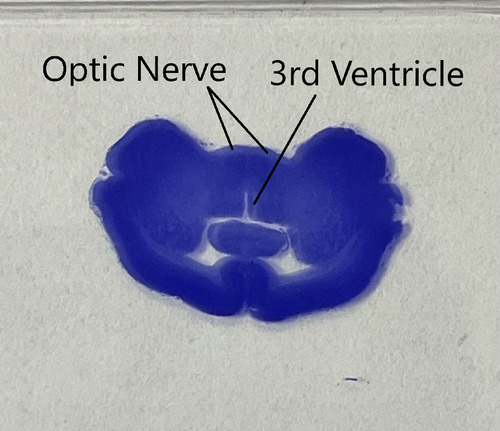 HYPOTHALAMUS (CS) CV   M SHOWING 3RD