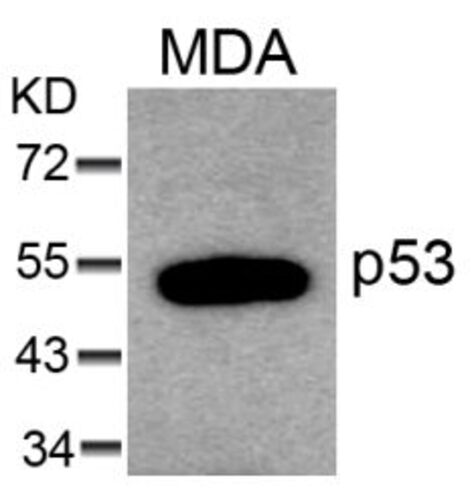 P53 (Ab 6) Antibody
