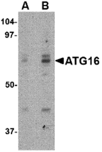 ATG16 antibody