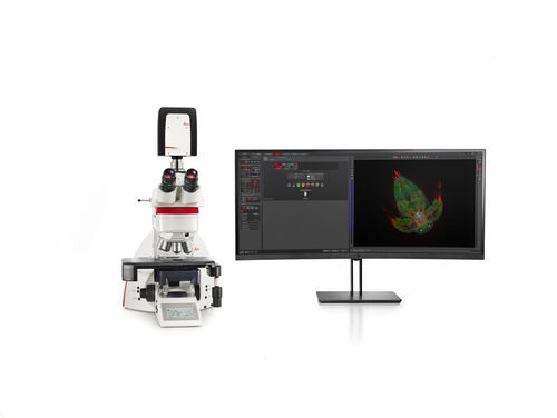 THUNDER Imager Tissue, allows real-time fluorescence imaging of 3D tissue sections typically used in neuroscience and histology research. Acquire rich, detailed images of thick tissues free of haze from out-of-focus blur, Rapidly acquire blur-free images showing finest details of the morphology