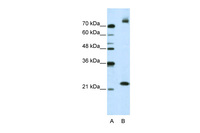 Anti-FZD9 Rabbit Polyclonal Antibody