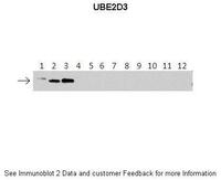 Anti-UBE2D3 Rabbit Polyclonal Antibody