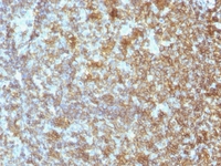 Anti-CD45 Mouse Monoclonal Antibody [clone: SPM496]