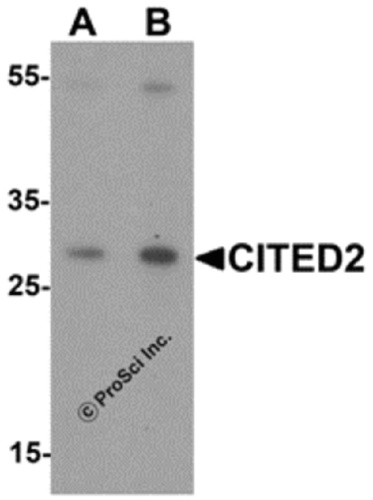 CITED2 antibody