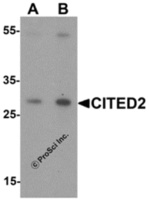 Anti-CITED2 Rabbit Polyclonal Antibody