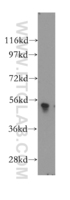 Anti-PLXDC2 Rabbit Polyclonal Antibody