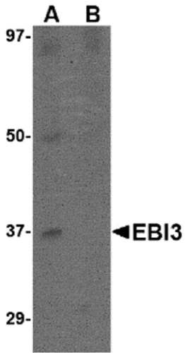 EBI3 antibody