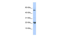 Anti-TNFSF12 Rabbit Polyclonal Antibody