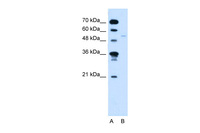 Anti-RXRG Rabbit Polyclonal Antibody