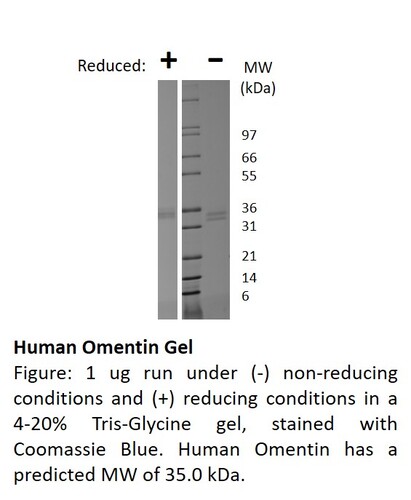 Human Recombinant Omentin (from <i>E. coli</i>)