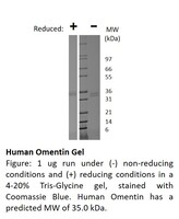 Human Recombinant Omentin (from E. coli)